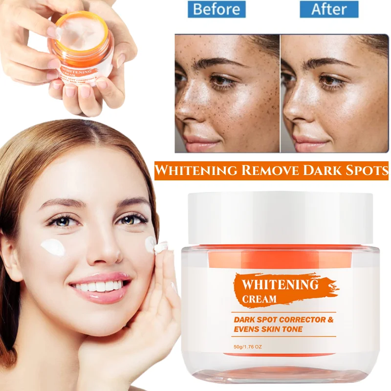 

Whitening Freckle Cream Fade Melanin Remove Dark Spots Improve Facial Pigmentation Brighten Skin Anti-Aging Facial Skin Care