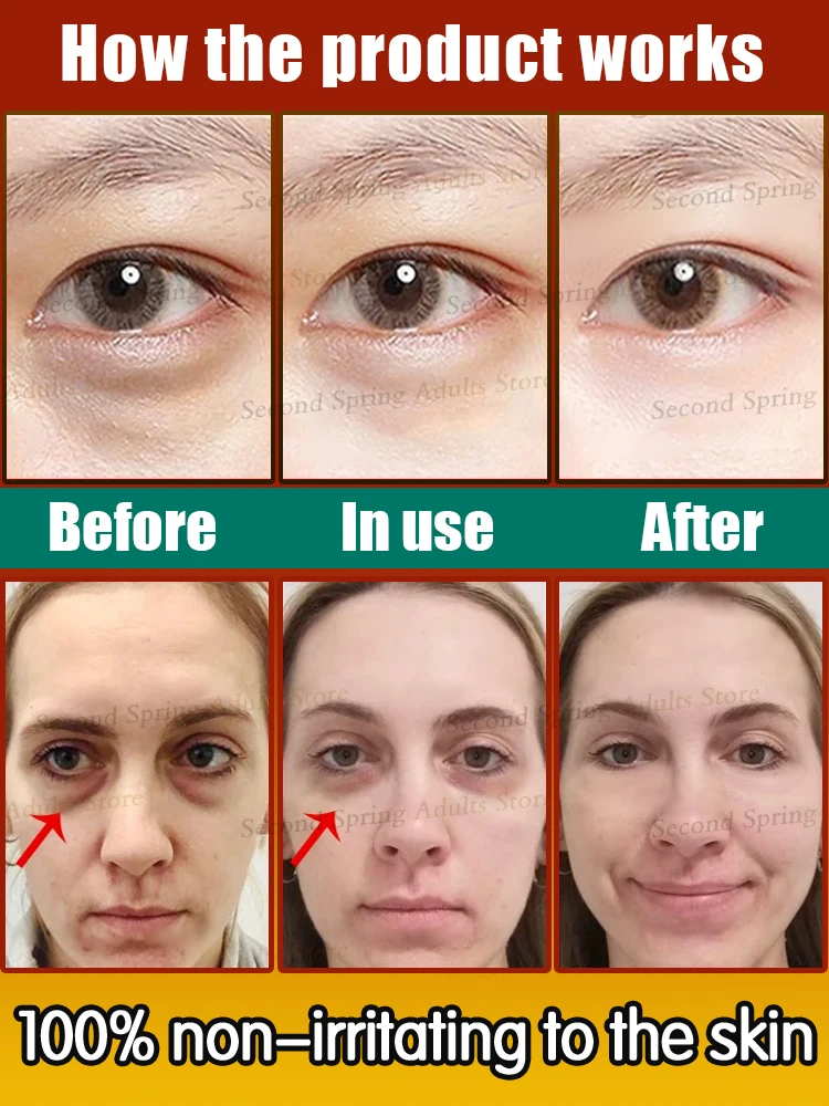 Eye Bag Solution Over 90% Buyer Says Eyes Bag Never Issue