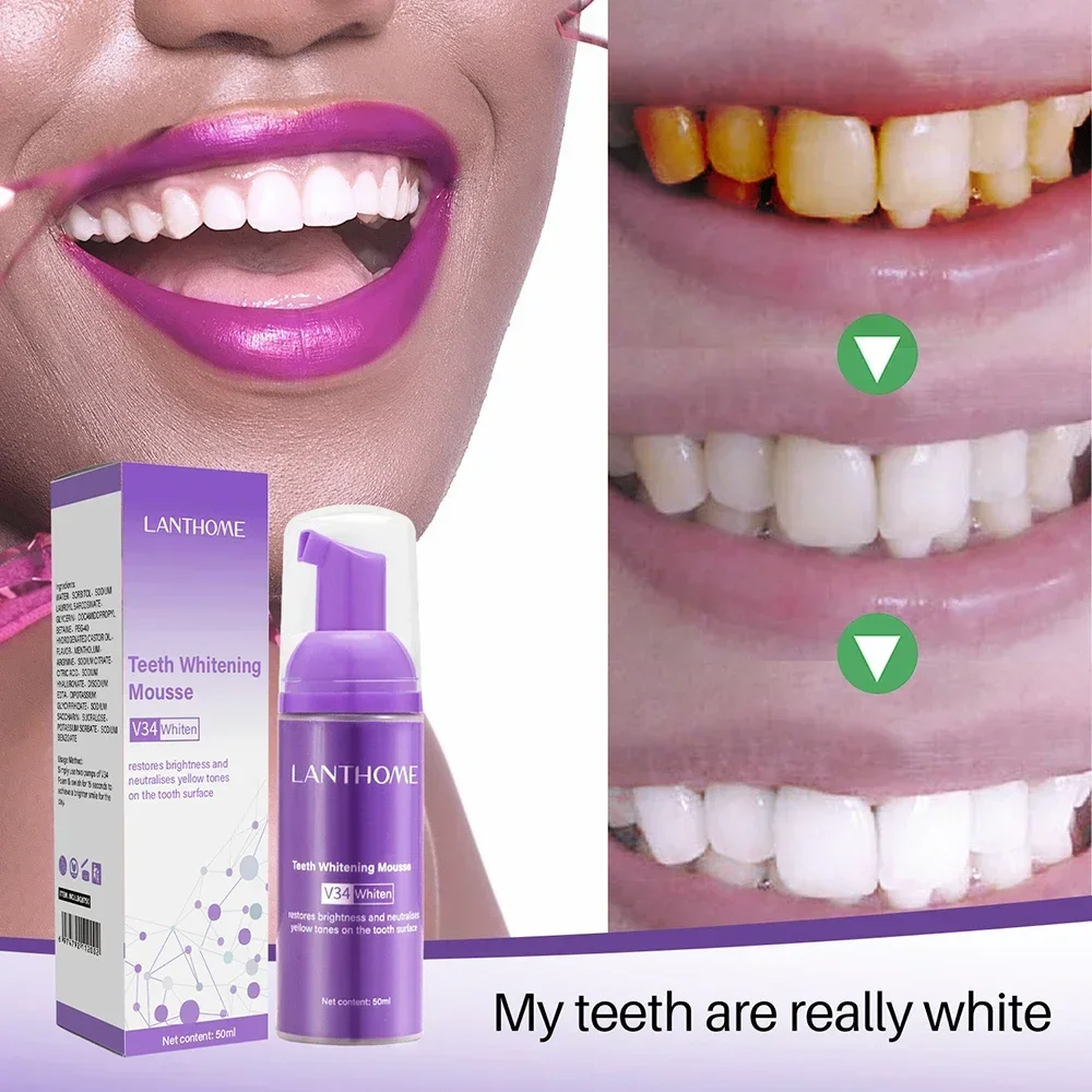 Teeth Whitening Product Teeth Whitening Essence V34 Mousse Toothpaste Teeth Whitening Removing Yellow Teeth Cleaning Tooth Stain Oral Fresh Tooth Care Product 50ml