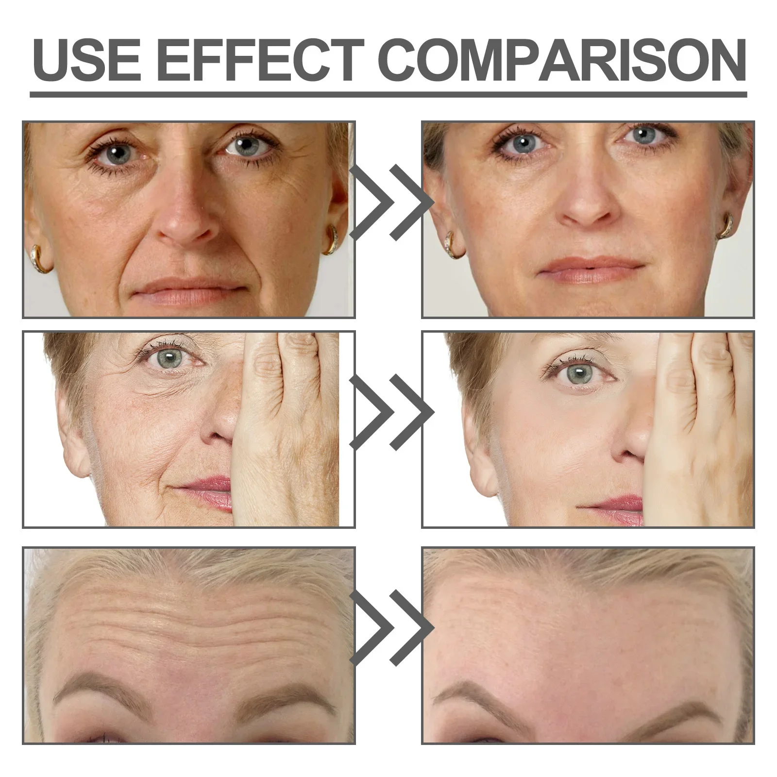 Crema antirughe Anti-età Rimozione macchie scure Riparazione Lifting Firm Dissolvenza Linee sottili Sbiancamento Idratante Cura della pelle del viso_voghion.com