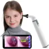 3.9mm 4.3mm Digital Otoscope Accessories Ear Specula Sets Ear Canal Inspection Tools 2