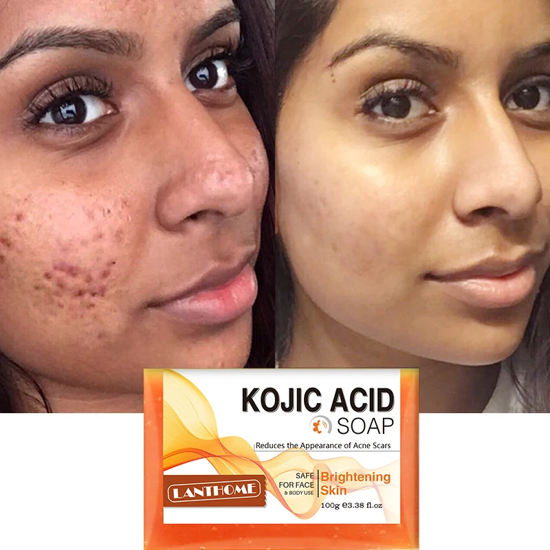 

100g Kojic Acid Whitening Soap Bar Hand Made Soap Moisturizing Deep Cleaning Lightening for Acne Dark Spot Brightening Skin Care