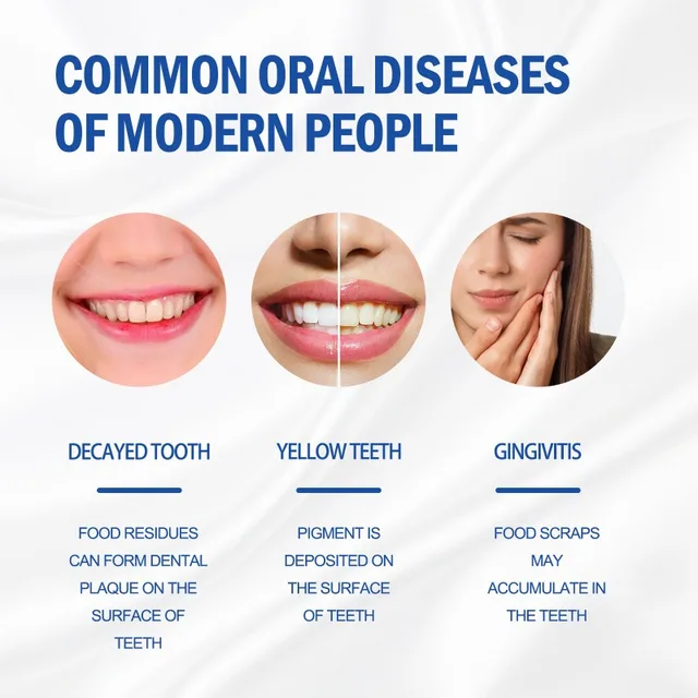 Sip-4 Probiotic Whitening Toothpaste Brightening & Stain Removing Sp-4 Probiotic Toothpaste Fresh Breath Teeth Whiten Toothpaste 4