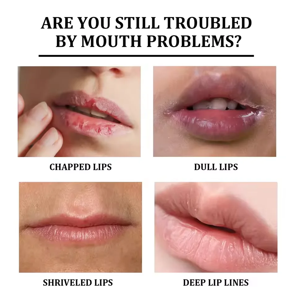 إزالة بلسم الشفاه الداكن سريع التفتيح الوردي الشفا...