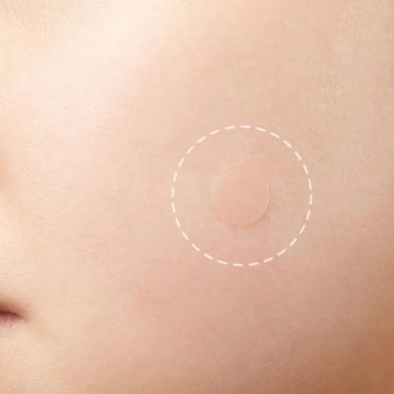 24pcs Face Acne Pimple Spot Scar Care Treatment Stickers Facial Skin Care Blackhead Removal Freckle Patches Acne Mask Beauty 5