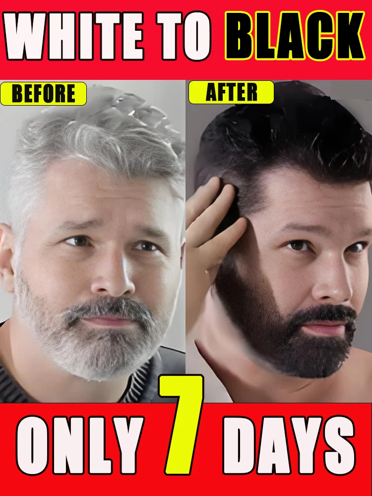 Hair Change Color My hair was white in the past but now it is black