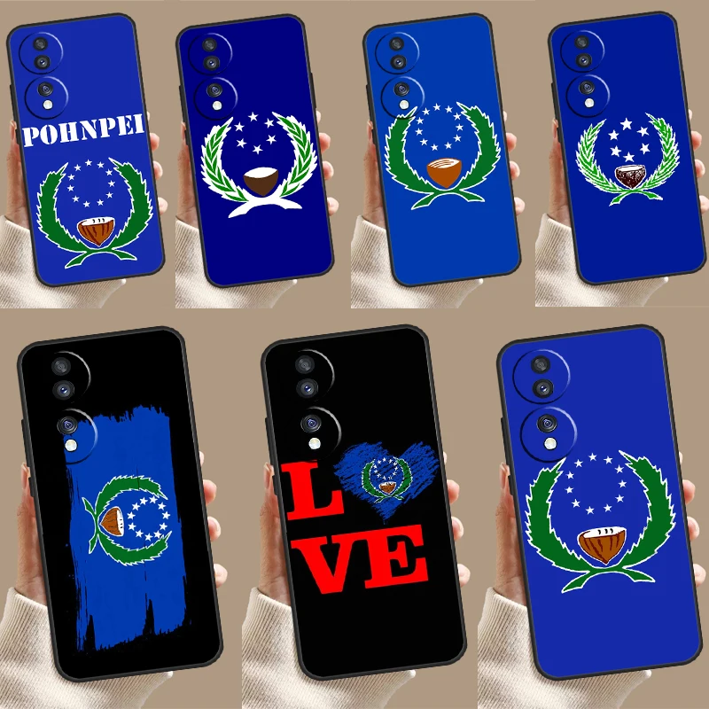 Чехол для Honor X8b X9b X6a X7a X8a X9a X6 X7 X8 X9 50 70 90 Magic 5 Lite Magic 6 Pro