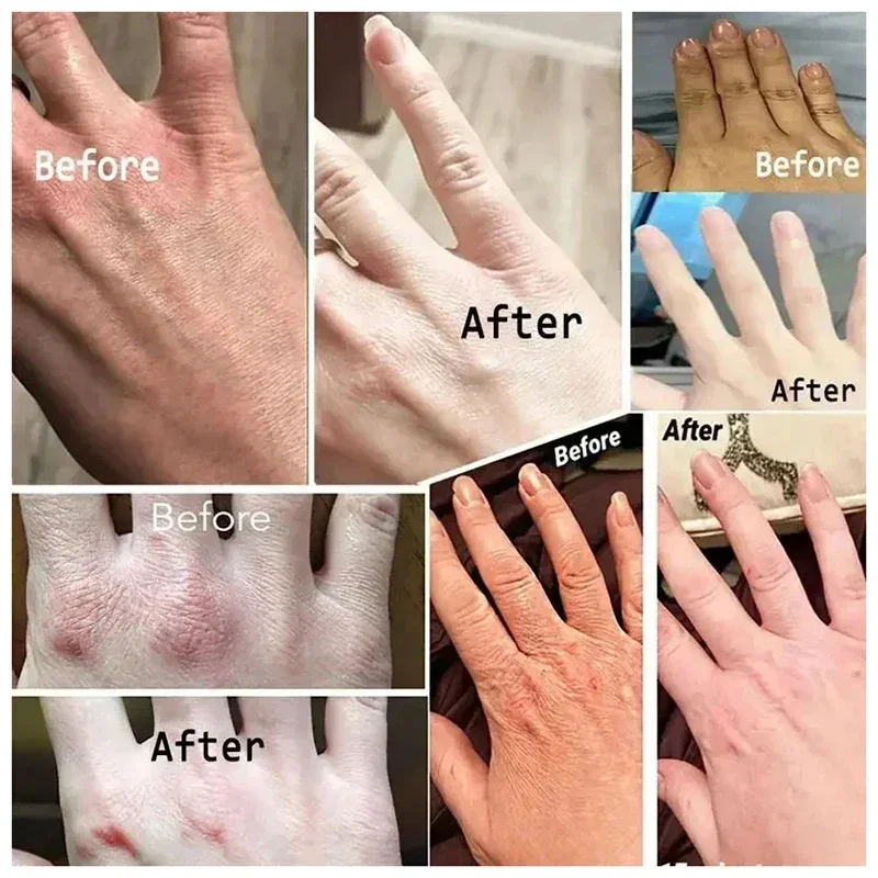 Dry hand repair