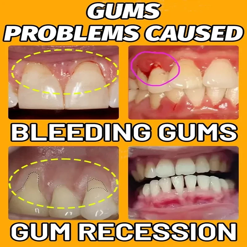 Whitening Teeth Essence teeth whitening product teeth whitening essence gum repair drops teeth health product effectively repair damaged gums Remove stains Clean teeth Oral dental care relieves swelling gums Expert