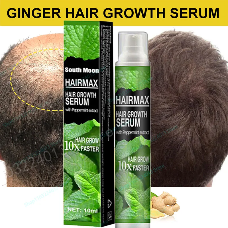 Anti Alopecia Fast Hair Growth Oil Essential Serum Hairless Baldhead Increase High Hairline Natural Head Hair Essence 30ml anti alopecia fast hair growth oil ginger essential serum hairless baldhead increase high hairline head hair essence cream