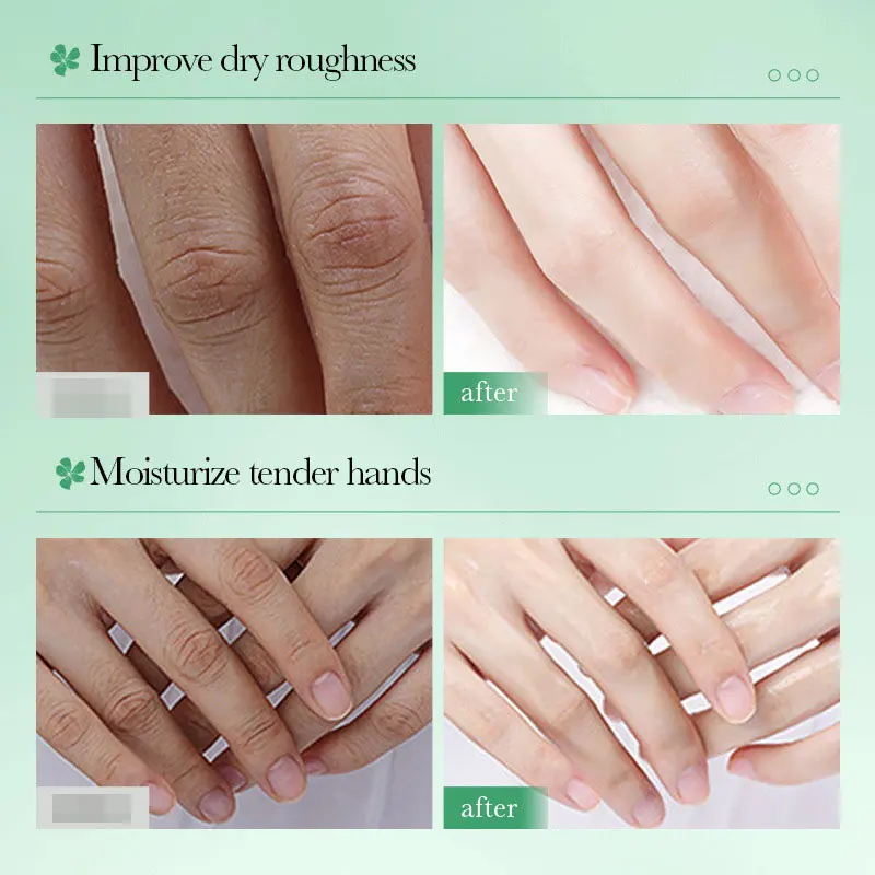 Aloe Lemon Hand Cream Fruit Series Moisturizing Anti-Wrinkle Moisturizing Anti-Drying Hand Cream