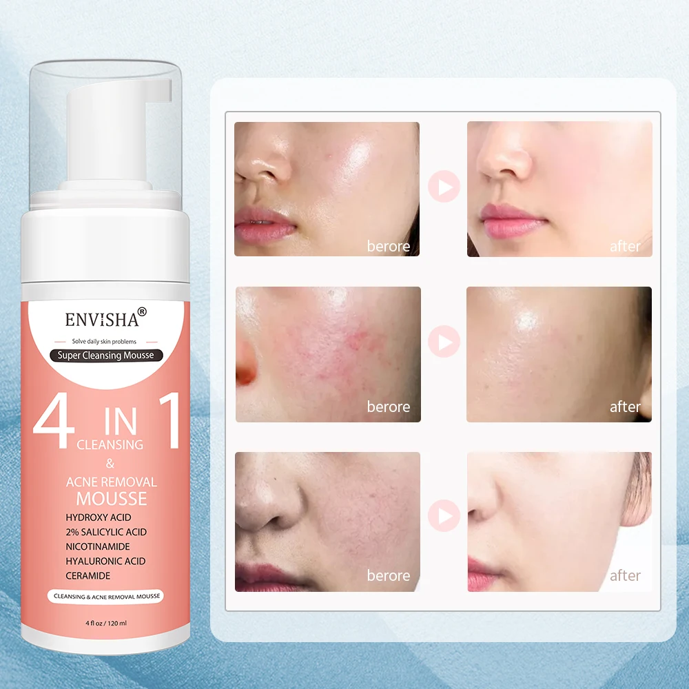 ENVISHA Cleaning Mousse Facial Skin Care Exfoliating Peeling Gel Deep Remove Smooth Moisturizing Cream Whitening Shrinking Pores 4