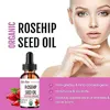 5ML/15ML/30ML/50ML/Pure Essential Oils Rosehip Oil Moisturizing Brighten Skin Color Essential Oil Anti-Dry Anti-Aging Face Essen 5