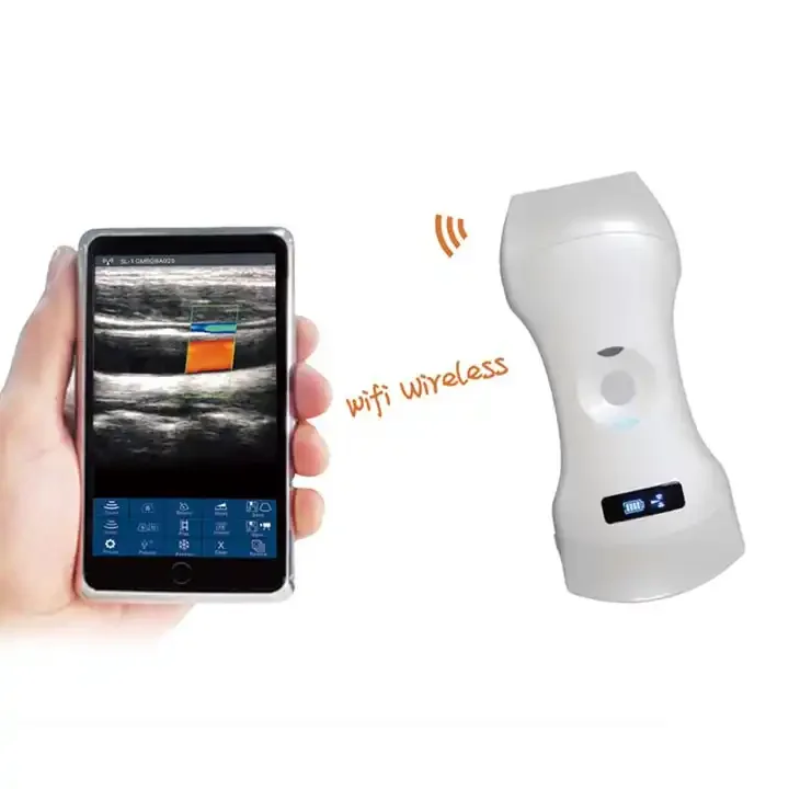 

192 Elements Wireless Ultrasound Probe Scanner Color Doppler 3 In 1 Portable Double Head Wifi-scanner USG Portable