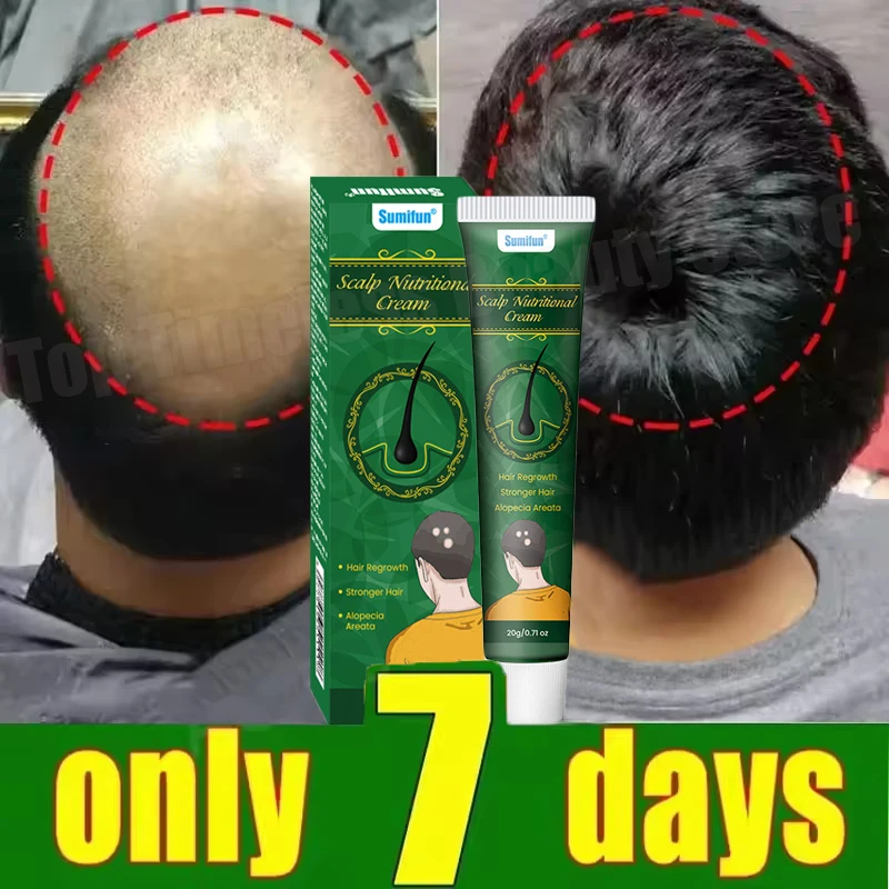 Ginger Hair Growth Cream Anti Hair Loss Baldness Repair Damaged Scalp Treatment Nourish Root Care Products Women Men