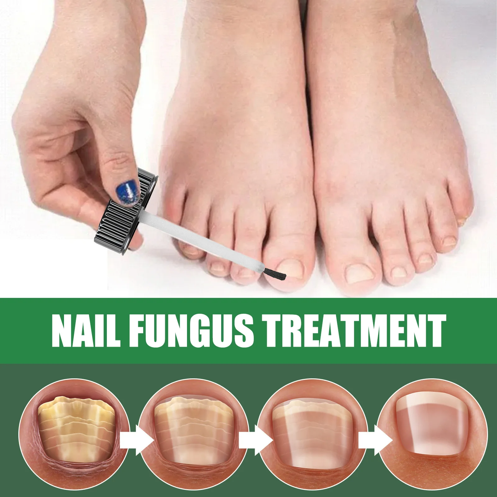 Fungal Nail Treatment Tea Tree Essence Oil Nail Fungus Repair Toenail Fingernail Ginger Treatment Hand Foot essence Liquid