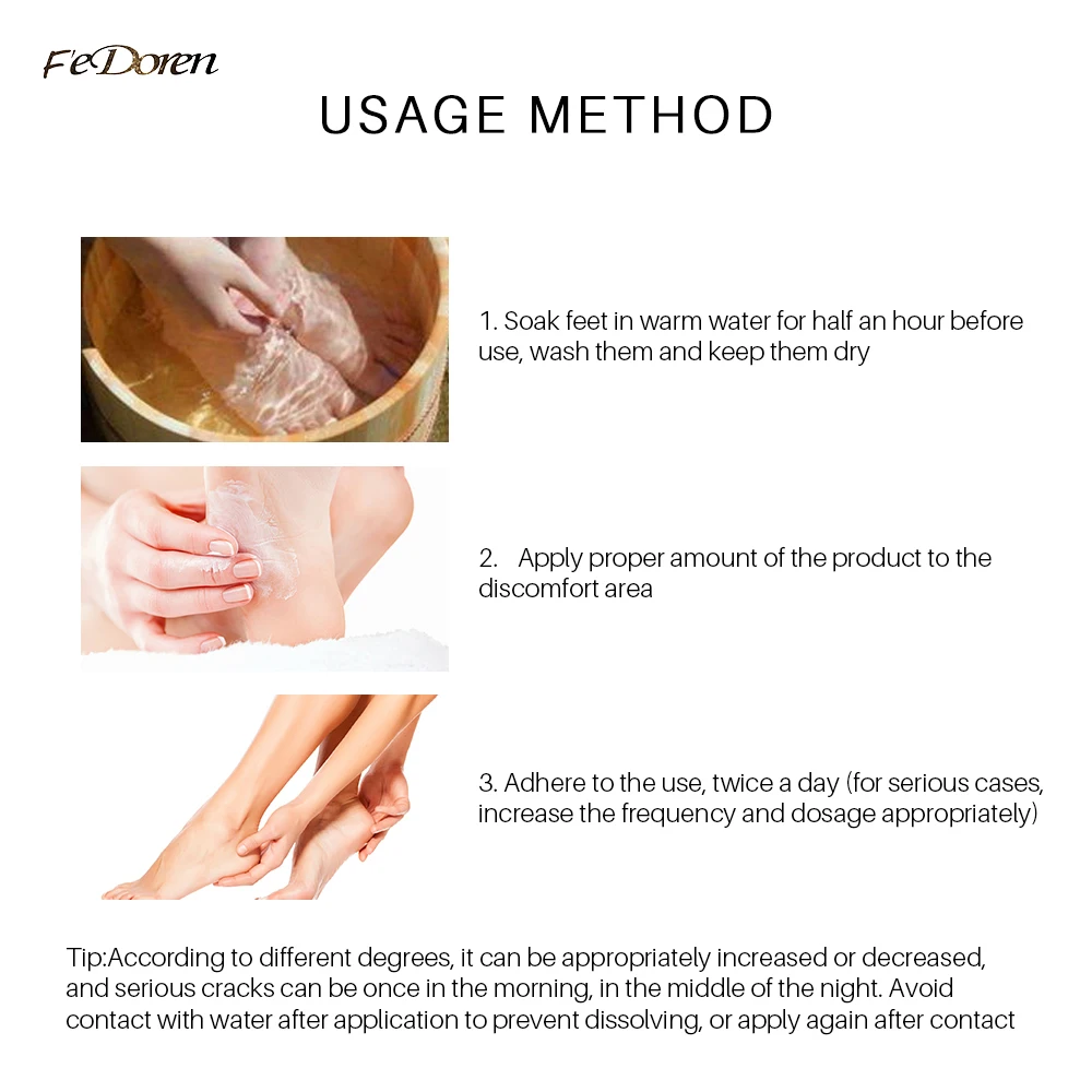 42% Urea Hand Foot Cream 2% Salicylic Acid fade Callus - Temu United Arab  Emirates