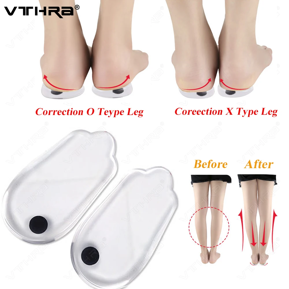 VTHRAVarusOrthoticInsoleXOLegsCorrectionSiliconeGelOrthopedic