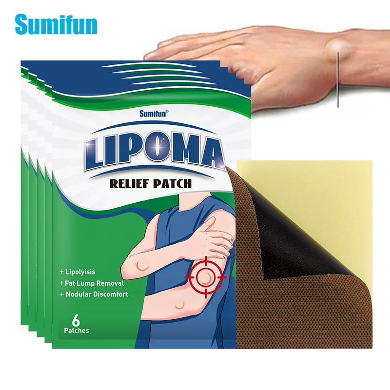 

6/18/30pcs Lipoma Removal Patch Antitumor Remove Fat Lump Plaster Nodular Discomfort Skin Cyst Swelling Pain Relief Stickers