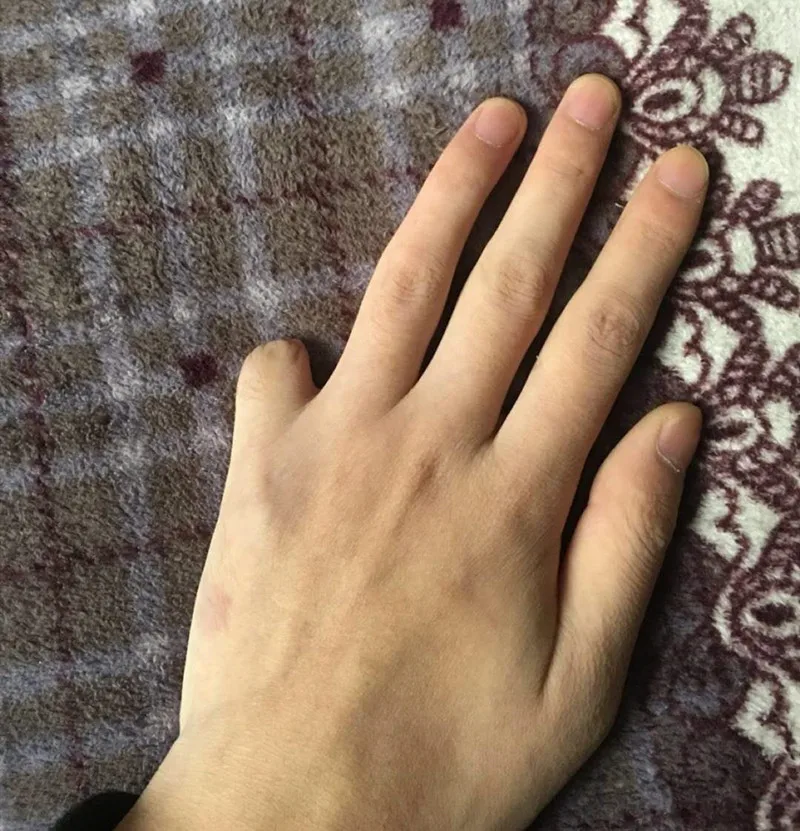 thumb