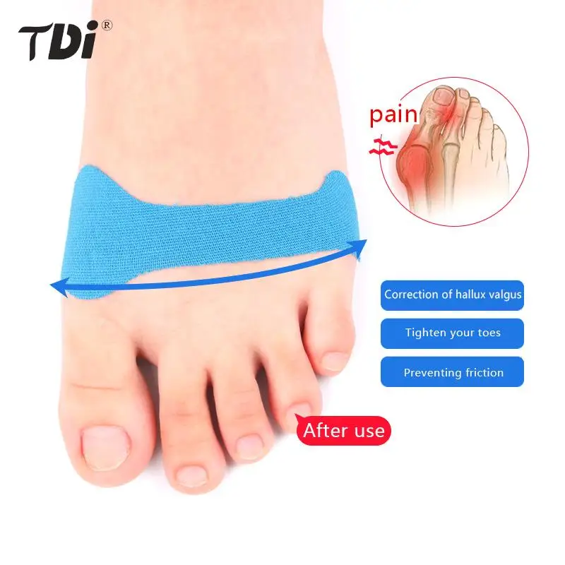 

5/10 шт., пластыри для разделения пальцев ног при вальгусной деформации