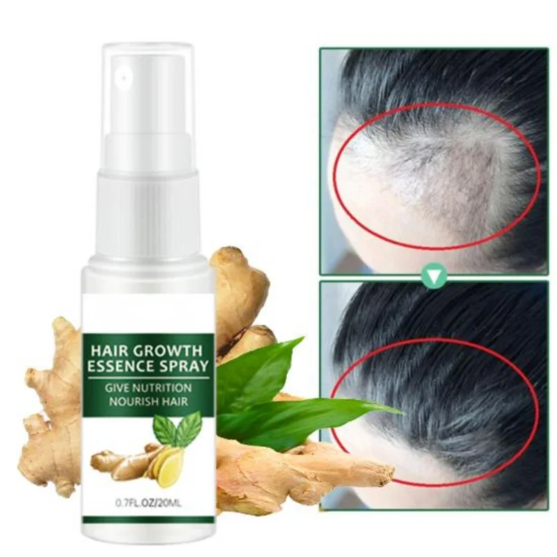 TRSTAYHairGrowthOilToolforAntiHairLossEssentialProductsFast