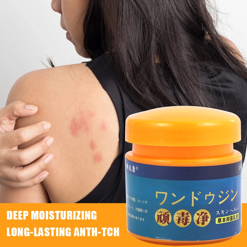 Scorpion Venom Skin Cream Relieve Psoriasis Eczema Allergic Dermatitis Herbal Antibacterial And Antipruritic 20g skin care ointment