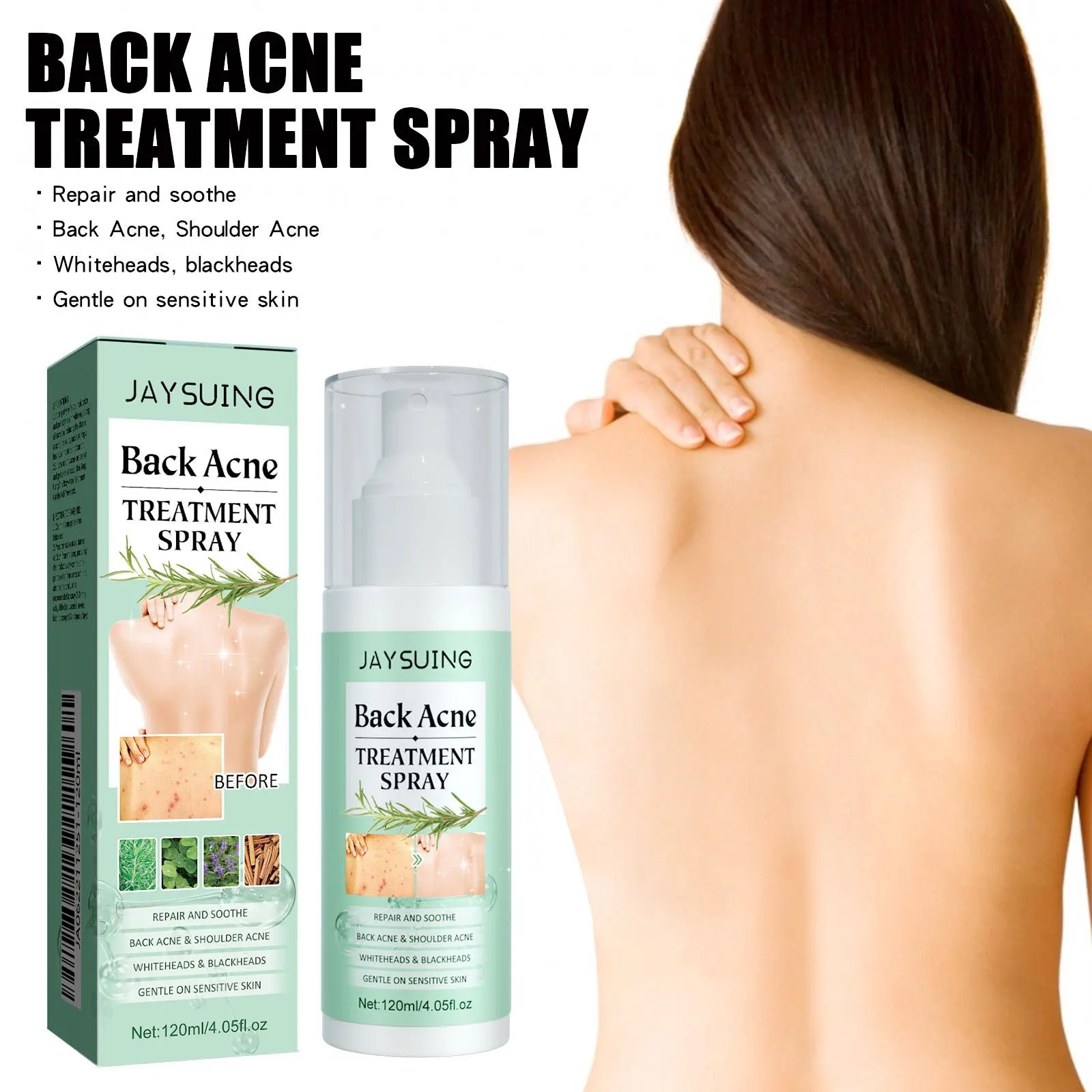Back Acne Remover Spray Shoulder Pimple Repair Whiteheads Treatment Blackhead Anti Mites Oil Control Hydrate Body Soothing Serum 3