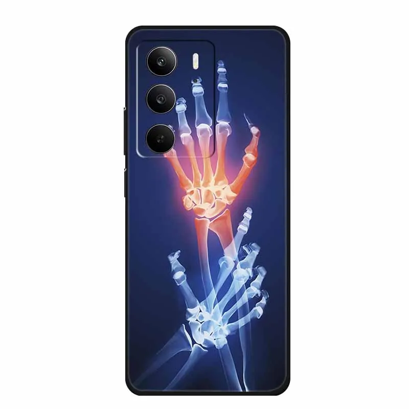 Fashion Black Silicone Soft Phone Case - Protective Back Cover