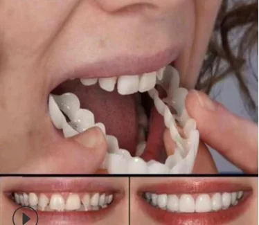 Simulation Braces Mamum Instant Smile Comfort Fit Flex Cosmetic Teeth Denture Teeth Top Cosmetic Veneer 3 set = 6 pieces
