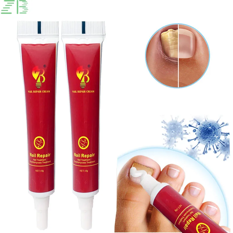 Treatment Fungal Nail Ointment Care Repair Foot Nail Fungus Removal Cream Anti Infection Paronychia Onychomycosis Product