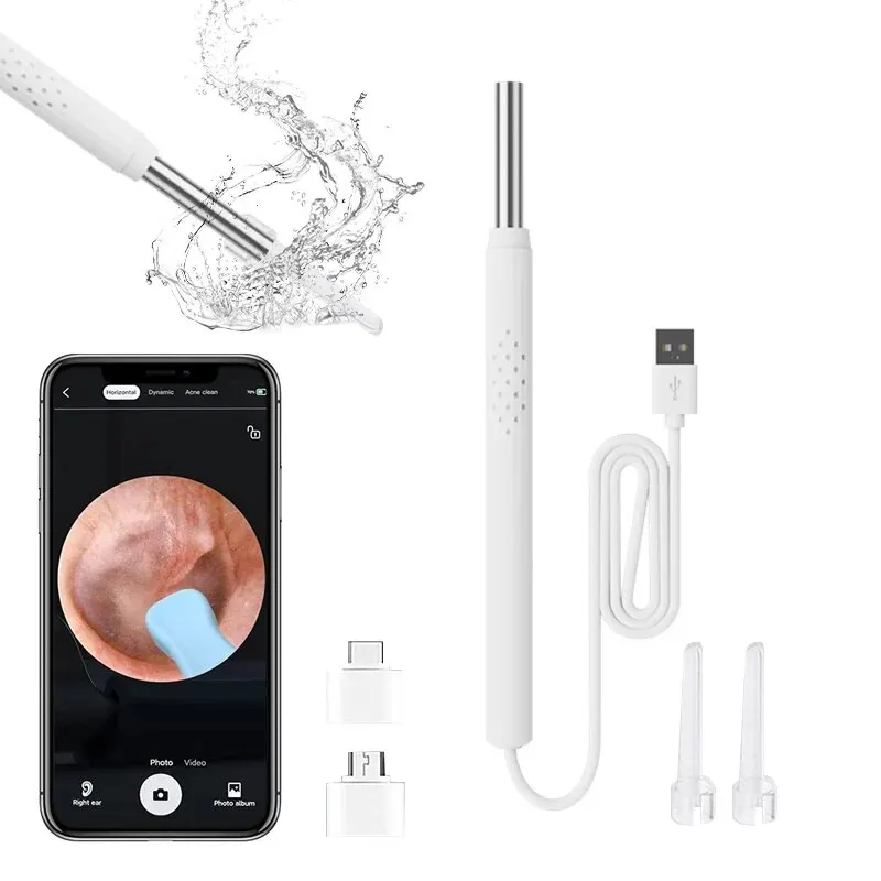 305373-5399a6.jpg Smart Visual Ear Cleaner 3 in 1 Ear Sticks Otoscope USB C Charging Endoscope Wax Removal Smart Visual Ear Cleaner 3-in-1 Ear Sticks Otoscope USB C Charging Endoscope Wax Removal Tool Earpick Mini Camera Health Care Mallzona