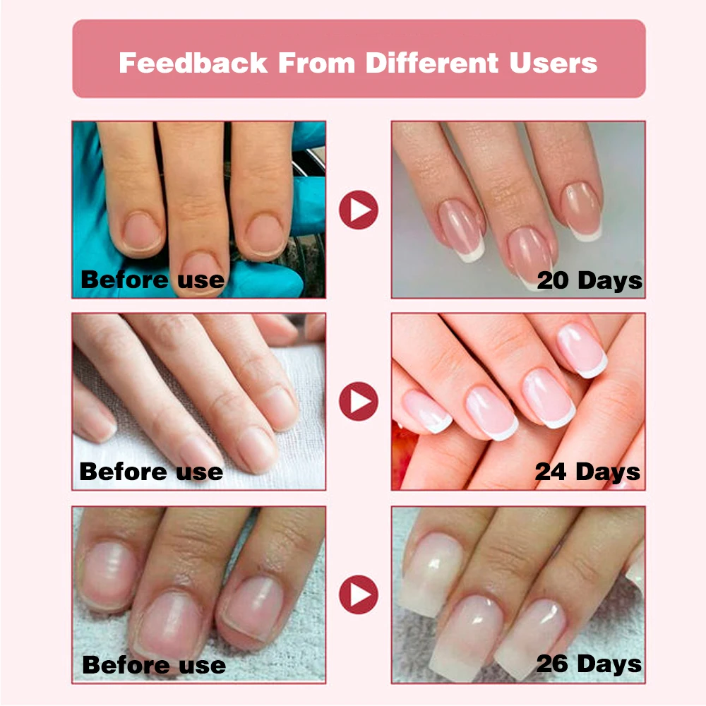 Nail Strengthener KODIES GEL Growth Restore Hardener Clear Nail Polish Base Coat Fast Dry 15ML Strong Repair Art Treatment