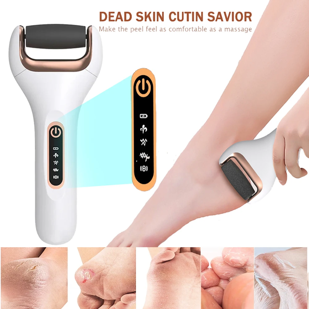 Feet Electric Sandpaper Rechargeable Foot Dead Skin Remover File Grinding  Removal Pedicure Calluses Heels Cracked Heels Portable - AliExpress