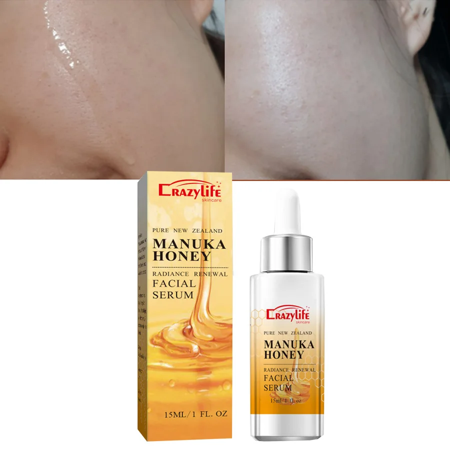 

Manuka Honey Gold Face Serum Repairing Essence Moisturizing Oil Control Shrink Pores Lifing Anti-wrinkle Face Serum