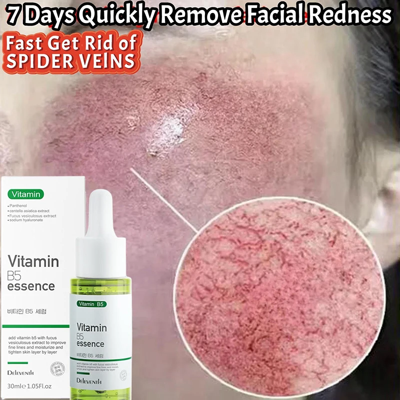 

Repair Facial Redness Serum Instant Spider Vein Remove Sensitive Skin Sooth Anti Redness Rosacea Treat Lotion Korean Cosmetics