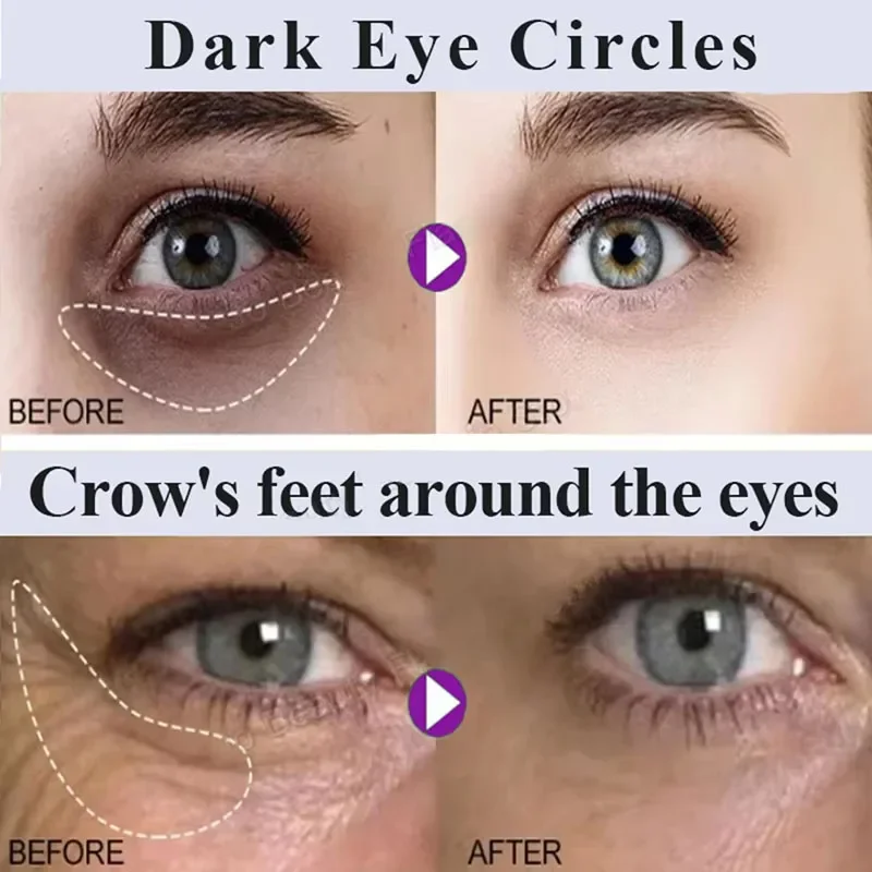 Pro-xylane Face Cream Anti-wrinkle Eye Cream Anti-Puffiness Eliminate Dark Circles Firming Deep Moisturizing Korean Skin Care - Image 2