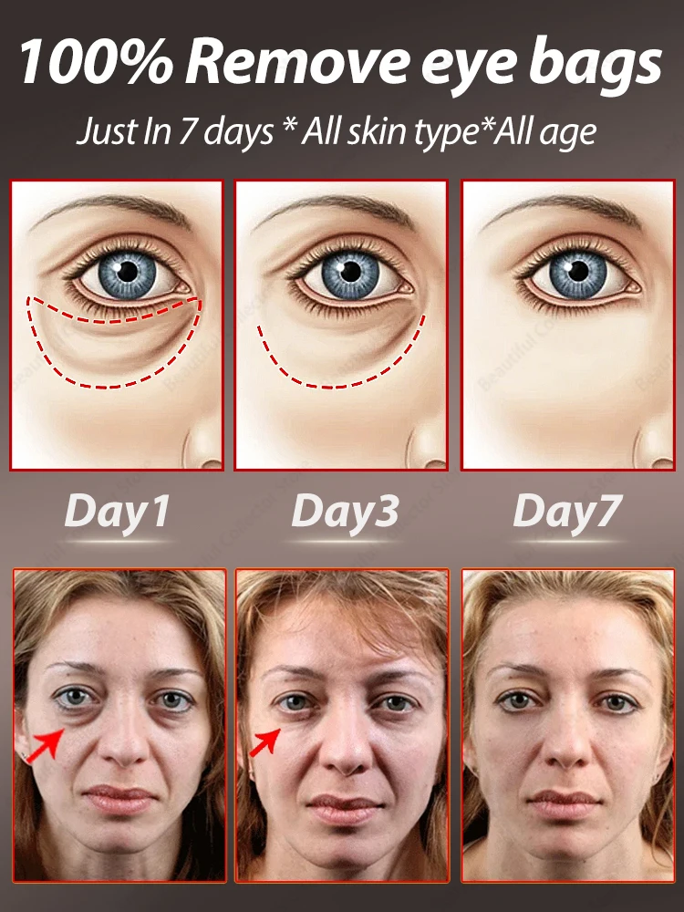 Eye Cream Eye Bags Disappear Care