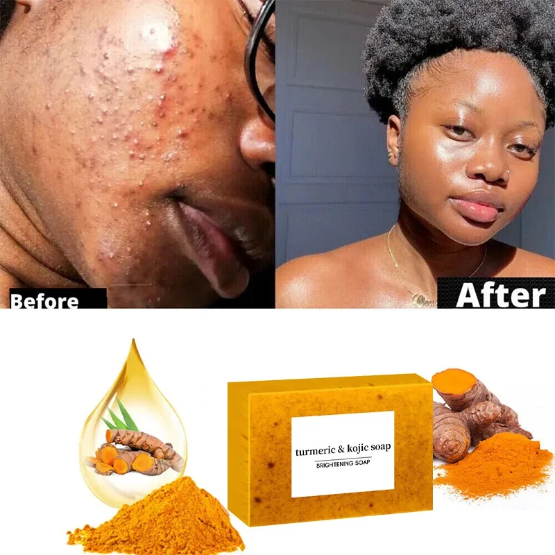 Turmeric Hand Soap Lemon Kojic Soap Bath Face Clean Skin Oil Control Natural Ingredients For Acne Skin Care 100g