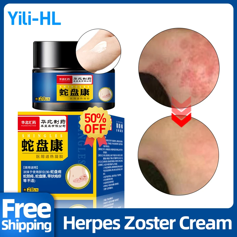 

Herpes Zoster Treatment Medicine Shingles Cream Herpes Simplex Cure For Snake Sore Red Dot Blister Skin Remover CFDA Approve