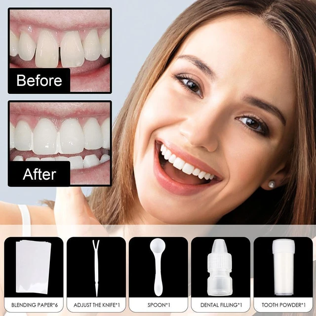 Shapeable Teeth Glue Set Party Makeup Temporary Filling Cavity Denture  Modification Tooth Filling U3H5