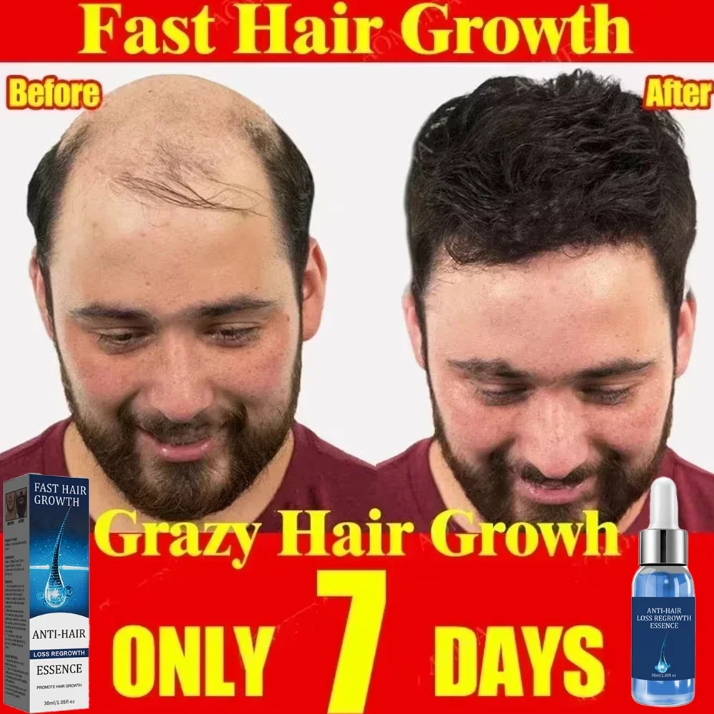 Hair Growth Serum Fast Hair Growth Oil Effective Baldness Repair Hereditary Hair Loss Postpartum Loss Seborrheic