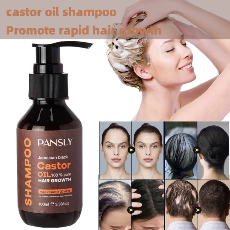 

Castor Oil Shampoo Deep Cleaning Anti-dandruff Antipruritic Oil Control Fast Hair Growth Effective Treatment for Hair Loss