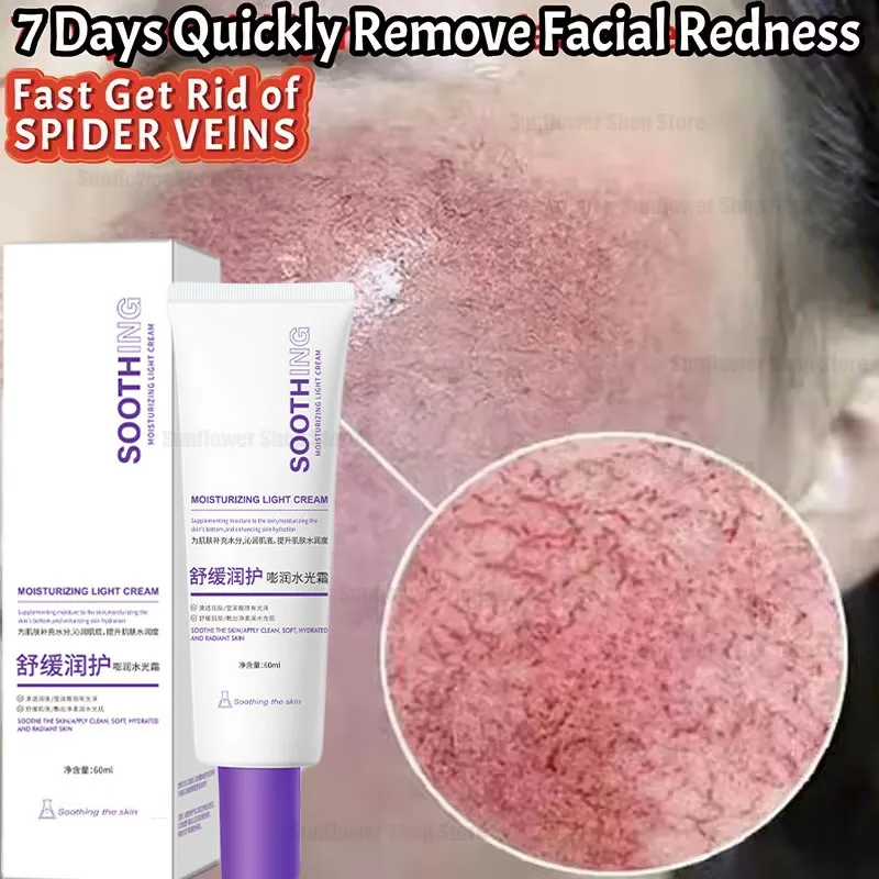 Repair Facial Redness Cream Instant Spider Vein Remove Sensitive Skin Sooth Anti Redness Rosacea Treat Lotion Korean Cosmetics