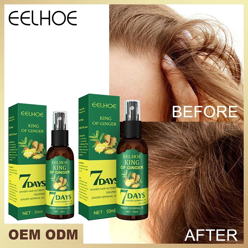 

Sdotter новое масло для роста волос имбирное эфирное масло для предотвращения эффективного выпадения волос лечение кожи головы утолщенные продукты для ухода за волосами для мужчин и женщин