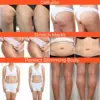 Slimming Weight Loss Body CareCream Remove Cellulite Lift Firming Shape Legs Beautiful Buttocks Anti Wrinkle Whitening 6