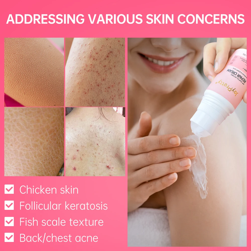 Vitamin C Body Cream Skin Keratosis Pilaris Lotion Rough Bumpy Pore Moisturizing Underarm Brightening Body Creams 4