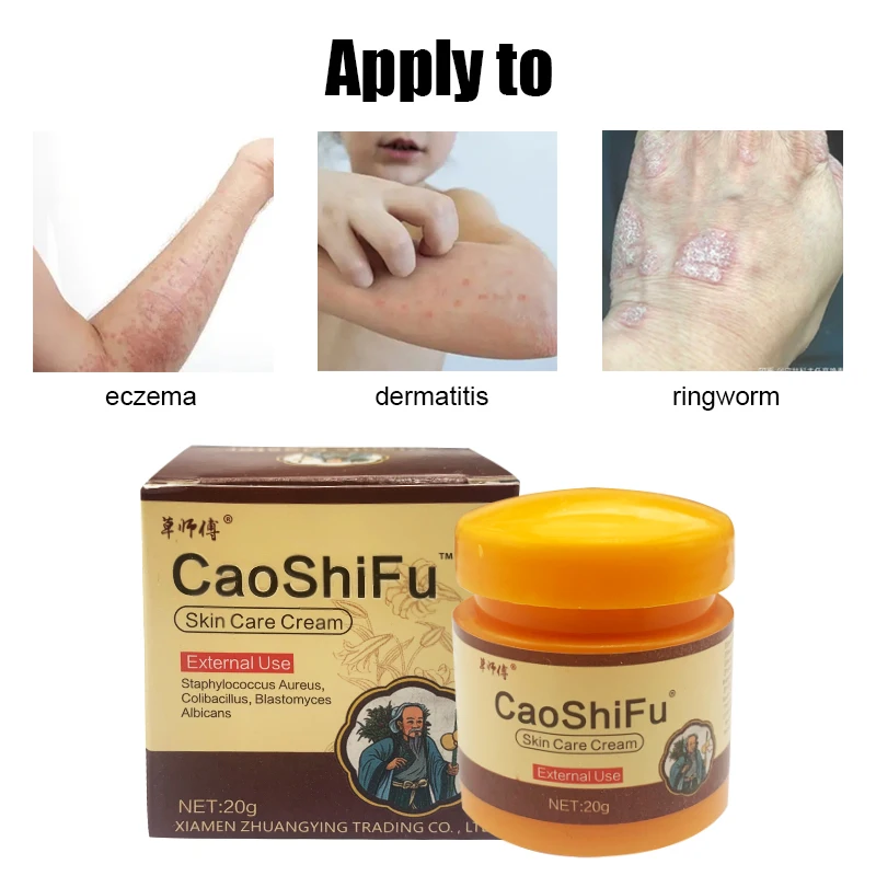 20g Psoriasis Antibacterial Cream Dermatitis Eczematoid Ointment Anti-Itch Chinese Herb Skin Care Cream Psoriasis Ointment