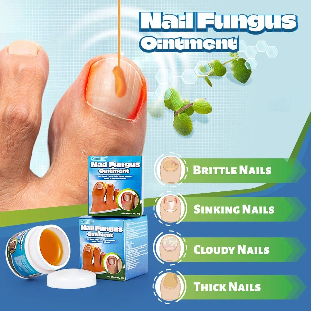Nail Fungus Remover Treatment Cream Anti Infection Onychomycosis Paronychia Repair Gel Toe Nail Fungal Removal Hand Foot Care Products