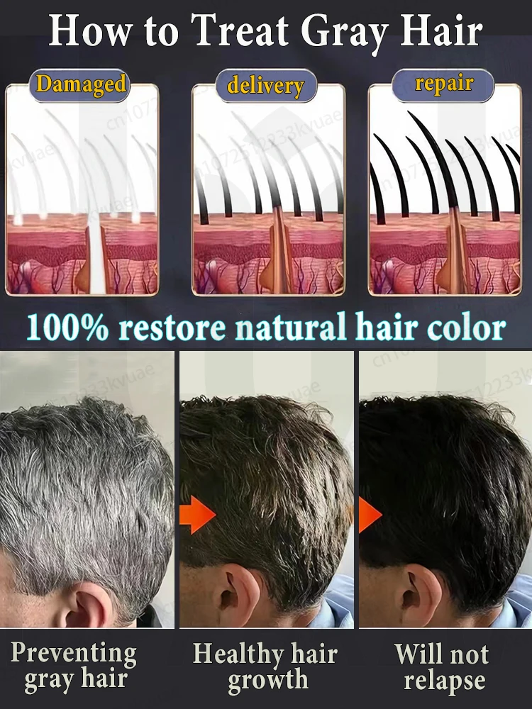 Hair Color Restorer White Hair Killer Used to turn white hair into black hair Nourish the scalp Suitable for white hair essence Repair care